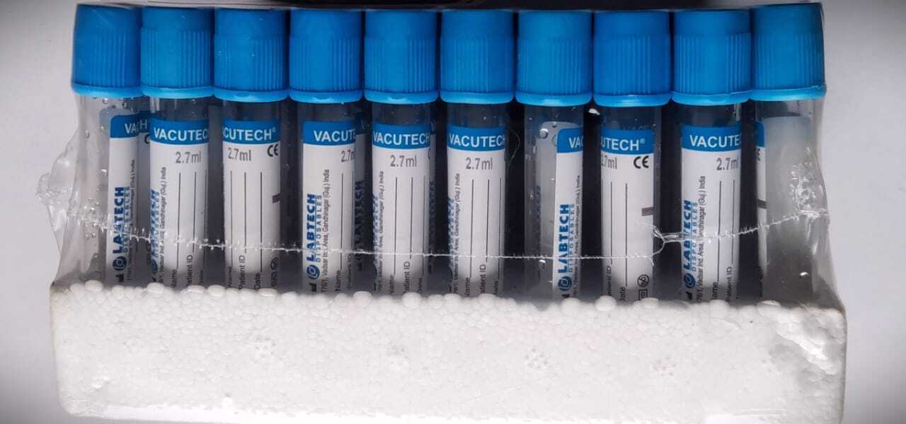 SciMed - Vacutainer Buffered Sodium Citrate Blood Collection Tubes Pack Of 100 Tubes