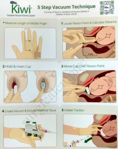 Gynecologist Kiwi Complete Vacuum Delivery System